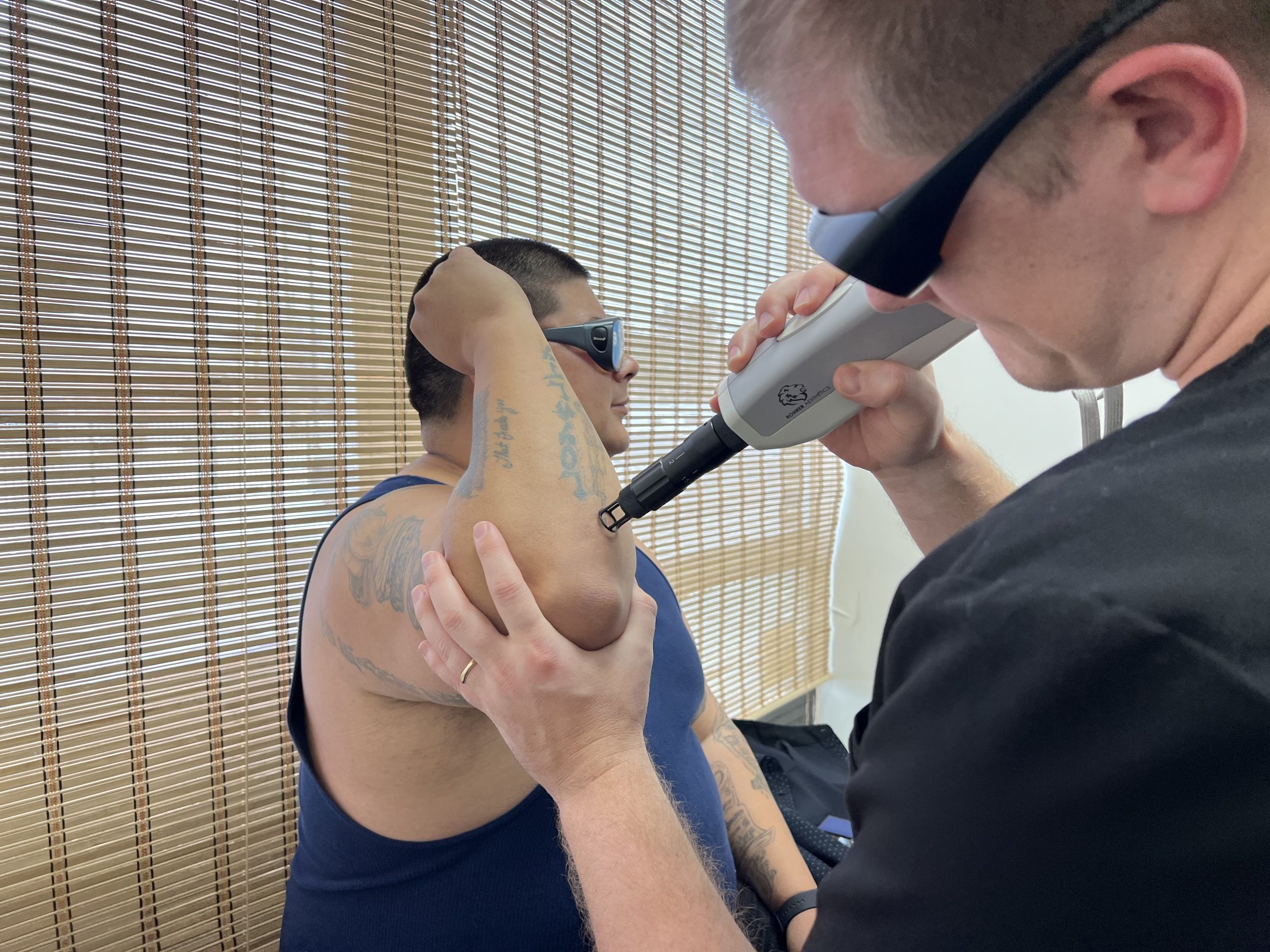 Beaumont dermatology residents remove tattoos to help people re-enter  society | Beaumont Health
